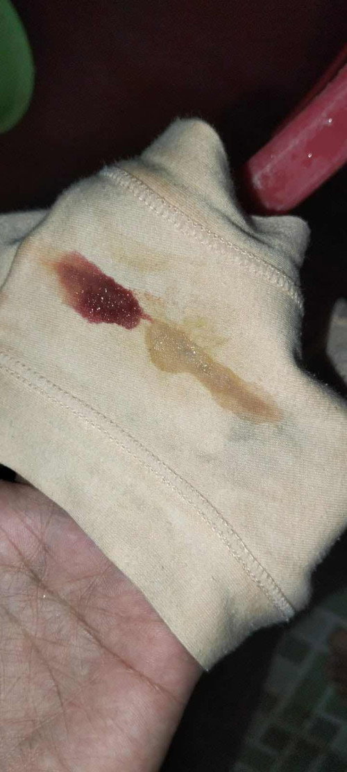 Telat haid 4 hari ada bercak keluar