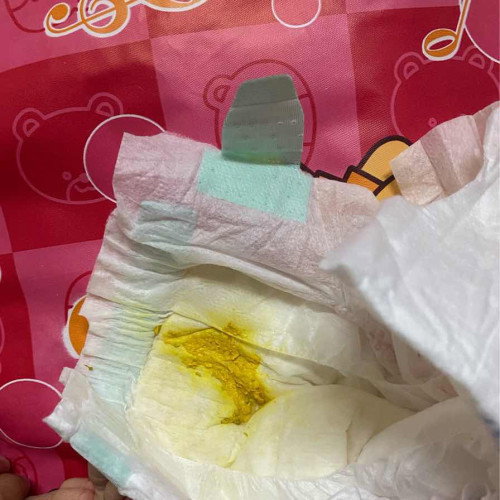 แบบนี้ผิดปกติไหมคะ