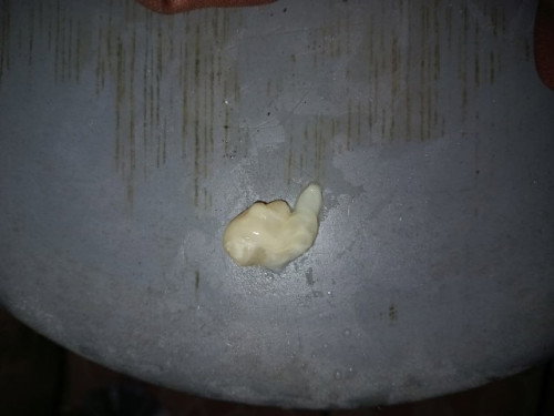 Keluar seperti putih telur