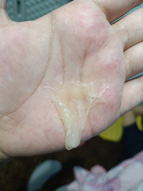 Keluar lendir