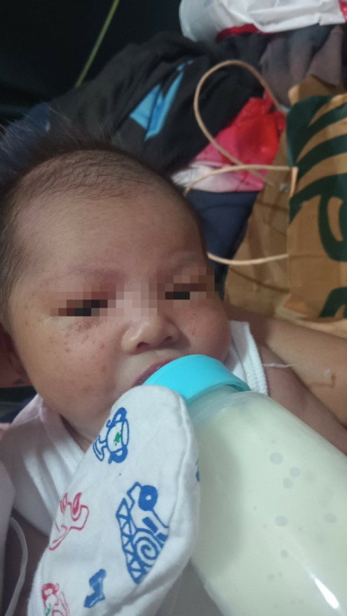 ano po kayang gamot sa mukha ni baby? ftm here