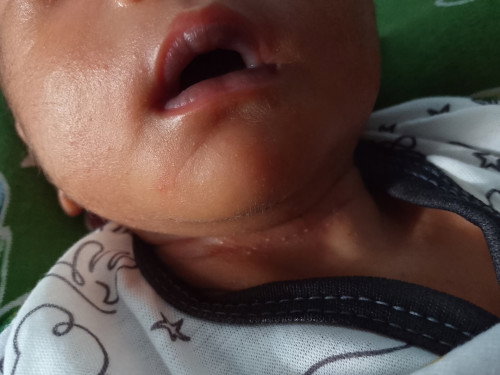 Bayi 11 hari