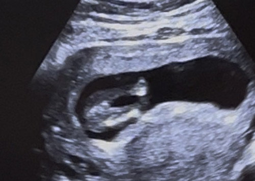 Boy or girl?