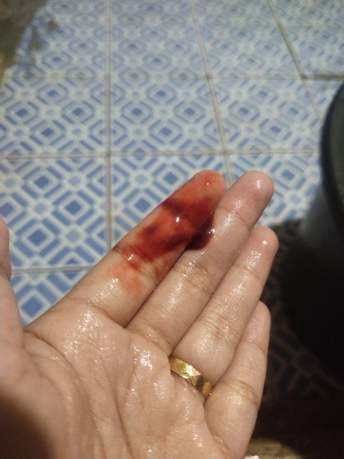 TM 1 Keluar flek