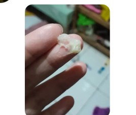 KEPUTIHAN KENTAL USIA 37WEEK 4DAY