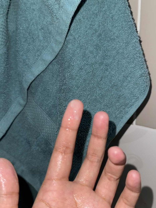 mucus plug