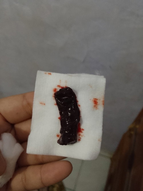 Perkiraan 6minggu