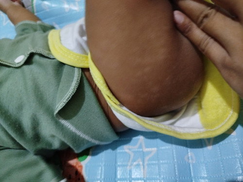 Kulit bayi ada putih putih