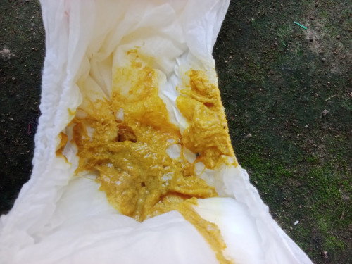 Bun..anakku baru umur 1thn 4 hari laluku beri sufor,2 hari ini pupnya spt itu, normal nggak ya pupny