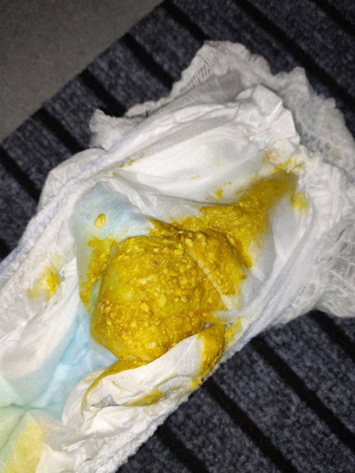 Bayi 9 bulan 8 hari berak 4 kali sehari