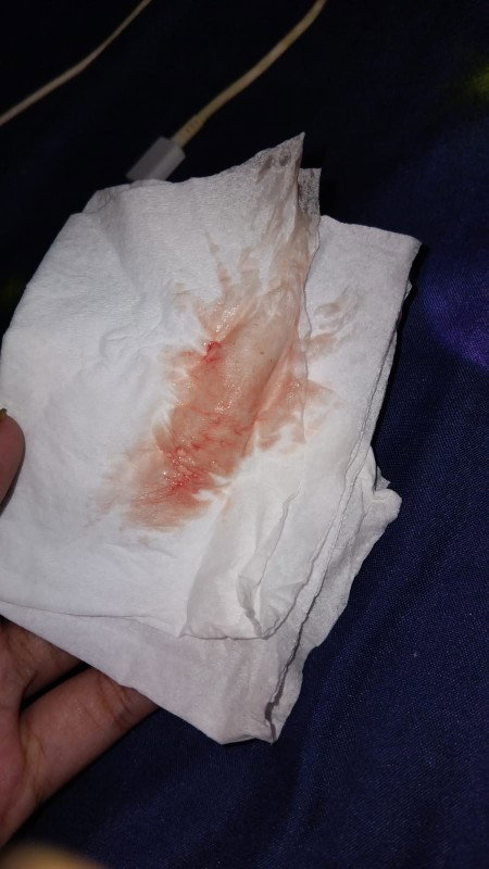 Mau nanya dong bund dari pagi keluar flek darah sampai skrg masuk igd di suru pulang ama dokter nya