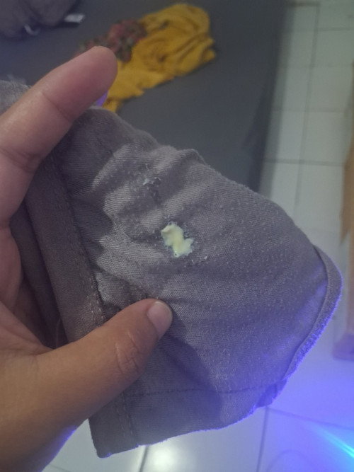 Apakah ini normal 36 week keputihan spt ini tp didalam bun mohon pencerahannya