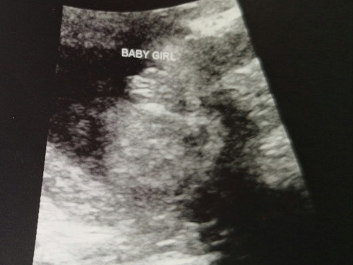 Girl or boy?