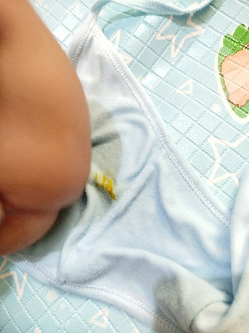 Bayi sering bab sedikit TPI terusan