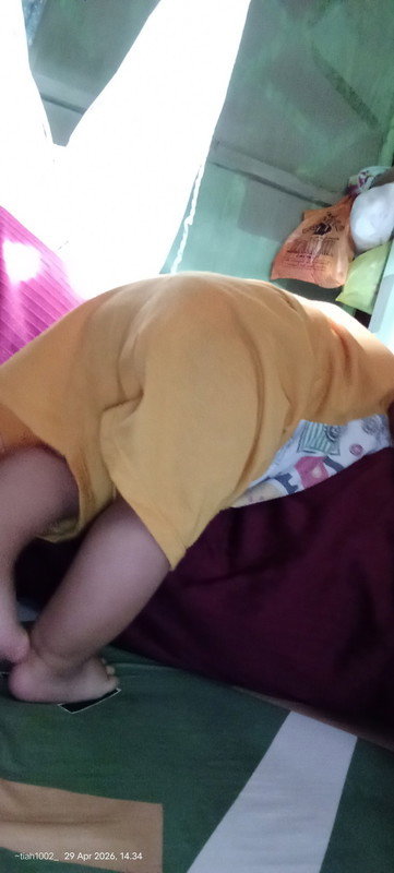 Bayi 7 bulan 27 hari belum bisa duduk mandiri