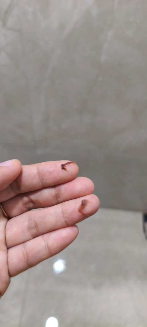 hamil 8 minggu muncul flek coklat