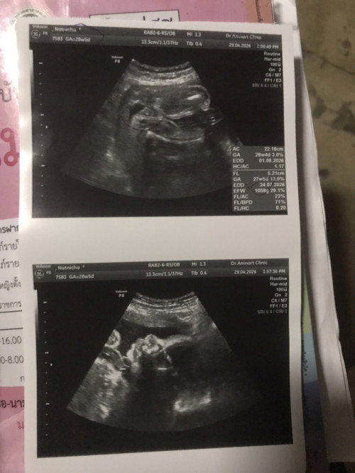 ทีมกรกฎาคม69 เป็นยังไงกันบ้างจ๊ะ มาแชร์กันน🤰🏻👧🏻