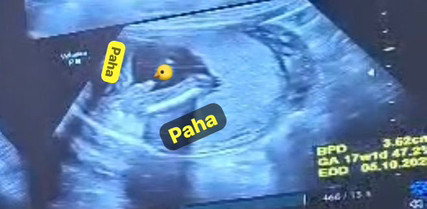Post reply image