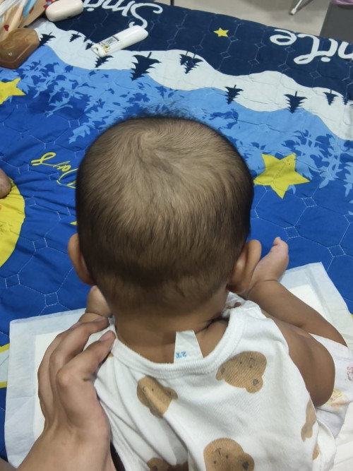 หัวลูกแบบนี้ปกติไหม