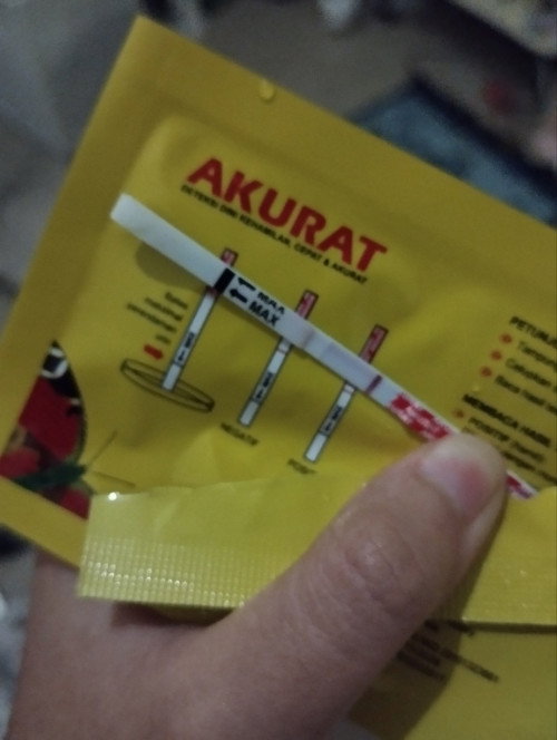 Ini tandanya apa ya bund?