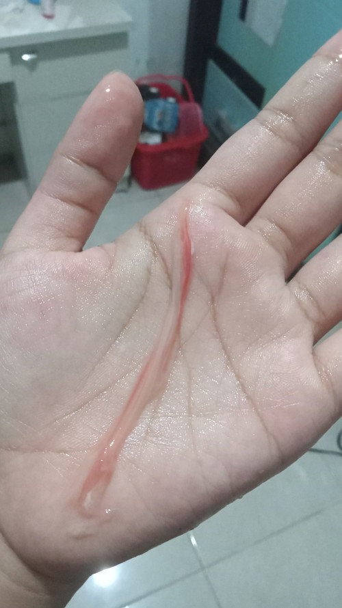keluar lendir di 37w