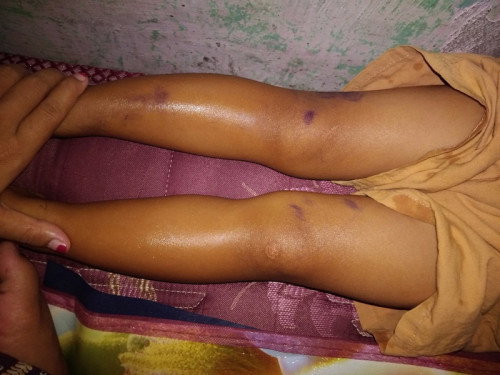 tulang kaki