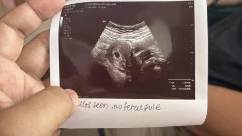 baby kedua