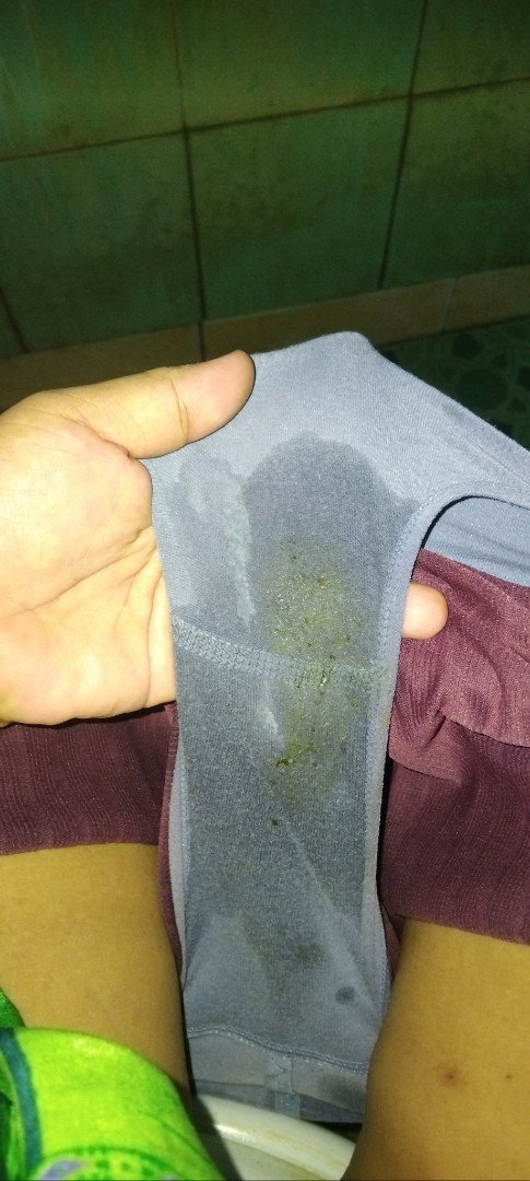 Keluar cairan