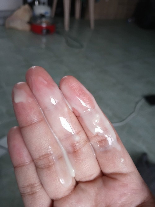 ตกขาวหรือน้ำคล่ำรั่ว