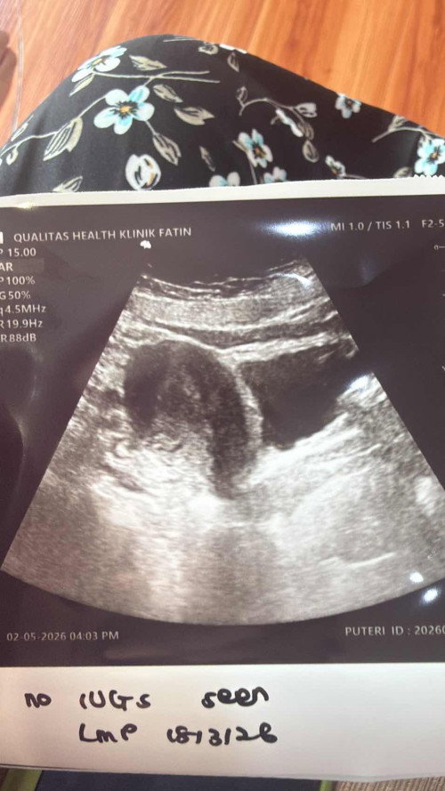 pregnant tapi keluar darah 😣
