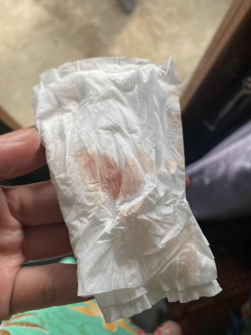 Flek di usia kehamilan 5 minggu