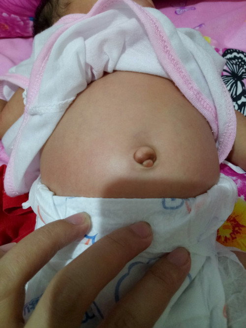 Pusod ni baby