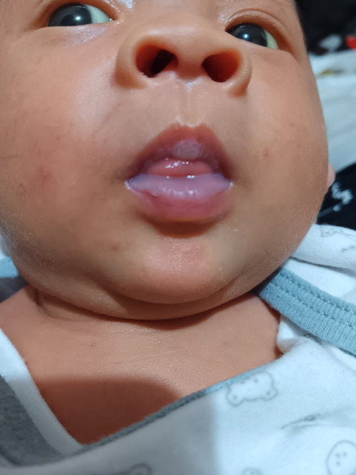 Bibir putih si kecil