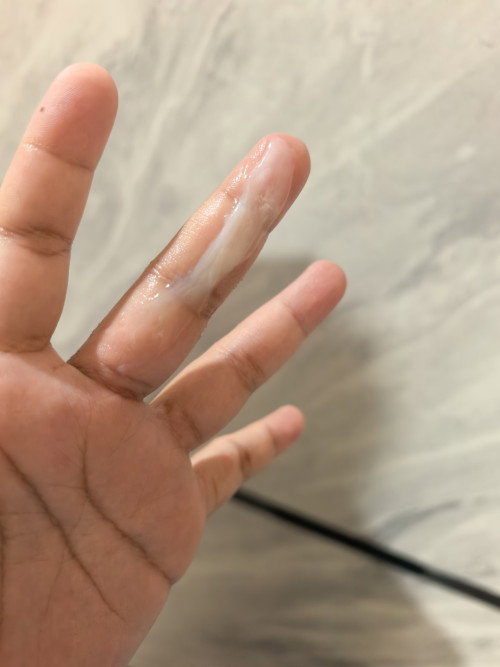 mucus plug ke ni?