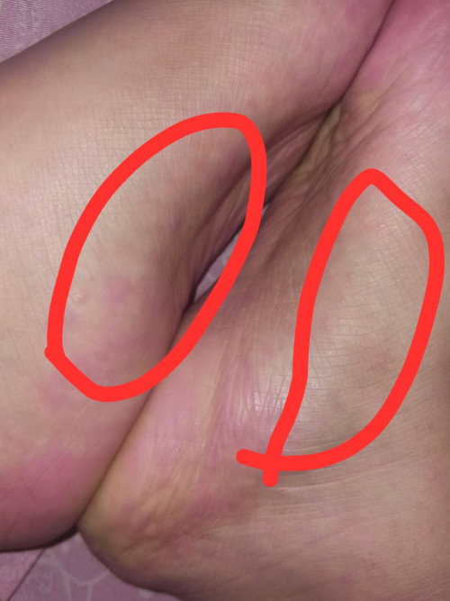 Kaki tangan melenting air