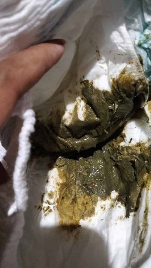 warna dan bau pop bayi