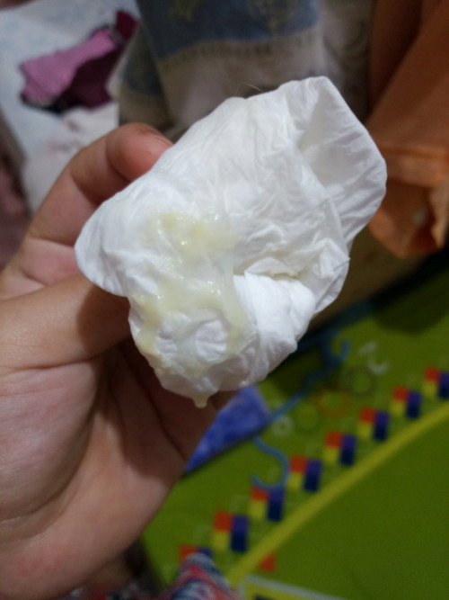 Mucus plug po ba ito?