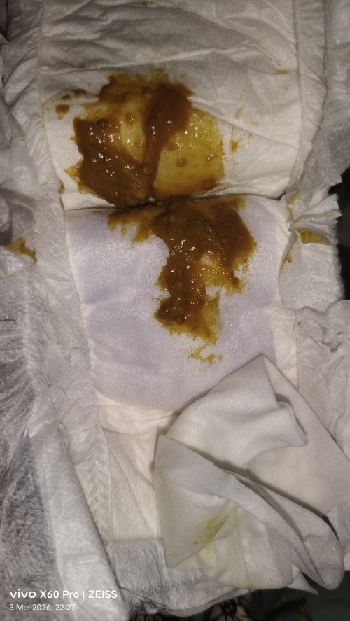 Berak normal atau tidak