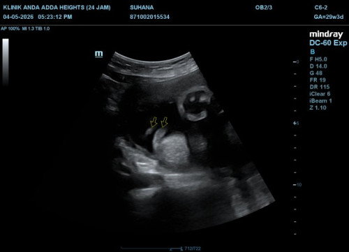 2D growth scan