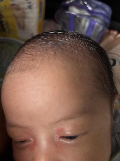 Sekitar mata bintik merah