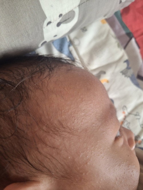 Biang keringat bayi