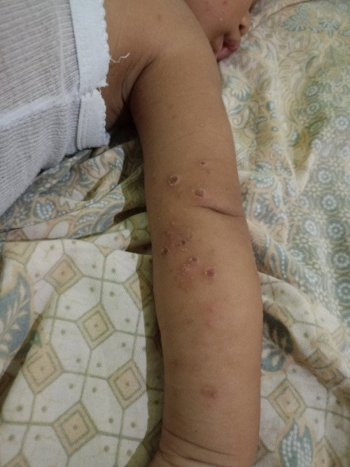 Bayi 10 bulan