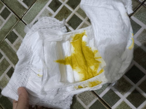 Apakah ini pup diare?