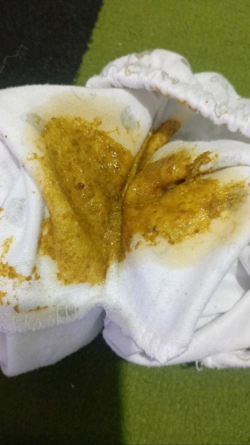 bayi 26 hari