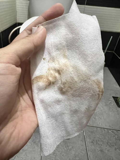Flek lagi setelah bertengkar dg suami