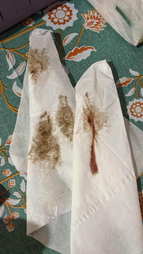 flek coklat dan lendir