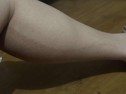 Garis hitam di kaki