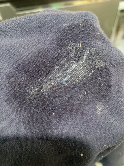 Mucus po ba ito?