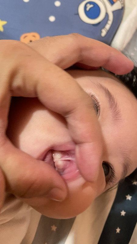 Is this Tounge Tie??