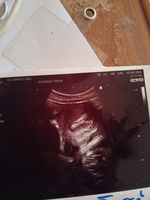 มาปรึกษาแม่ที่มีประสบการ